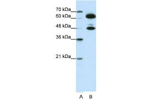 WB Suggested Anti-SNRP70  Antibody Titration: 0. (SNRNP70 Antikörper  (C-Term))