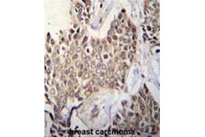 ZBTB42 Antibody (N-term) immunohistochemistry analysis in formalin fixed and paraffin embedded human breast tissue followed by peroxidase conjugation of the secondary antibody and DAB staining. (ZBTB42 Antikörper  (N-Term))