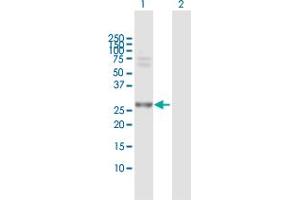 Western Blot analysis of PSMA7 expression in transfected 293T cell line by PSMA7 MaxPab polyclonal antibody. (PSMA7 Antikörper  (AA 1-248))