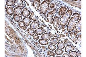 Immunohistochemistry (IHC) image for anti-B-Cell CLL/lymphoma 7A (BCL7A) (C-Term) antibody (ABIN2854648)