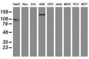 Image no. 2 for anti-ATP/GTP Binding Protein 1 (AGTPBP1) (AA 368-753) antibody (ABIN1491462) (AGTPBP1 Antikörper  (AA 368-753))