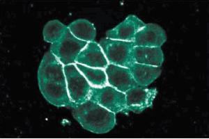 Immunofluorescence staining of WiDr cells (Human colorectal adenocarcinoma, ATCC CCL-218). (ITGA2 Antikörper  (AA 42-245))