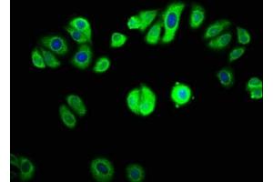 Immunofluorescence staining of HepG2 cells with  at 1:133, counter-stained with DAPI. (GAB1 Antikörper  (AA 119-329))