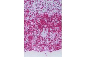 Detection of HEL at Human atherosclerotic lesions. (N epsilon Hexanoyl-Keyhole Limpet Hemocyanin (HEL-KLH) Antikörper)