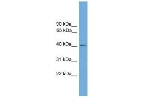 WB Suggested Anti-ZDHHC18 Antibody Titration:  0. (ZDHHC18 Antikörper  (Middle Region))
