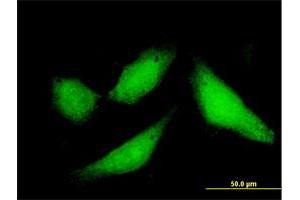Immunofluorescence of purified MaxPab antibody to CPXCR1 on HeLa cell. (CPXCR1 Antikörper  (AA 1-301))