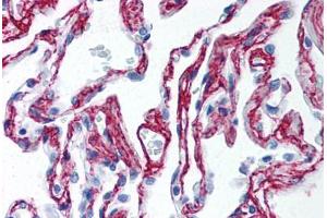 Human Lung (formalin-fixed, paraffin-embedded) stained with Collagen VI antibody ABIN364508 at 2. (COL6 Antikörper)
