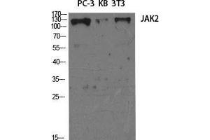 Western Blot (WB) analysis of specific cells using JAK2 Polyclonal Antibody. (JAK2 Antikörper  (Ser64))
