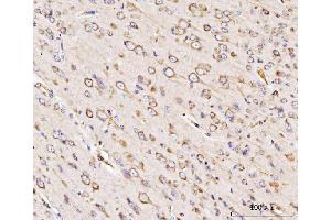 IHC analysis of GRP94 using anti-GRP94 antibody (ABIN3042463).