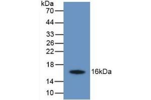 Detection of Recombinant TMEM27, Human using Monoclonal Antibody to Transmembrane Protein 27 (TMEM27) (TMEM27 Antikörper  (AA 17-137))