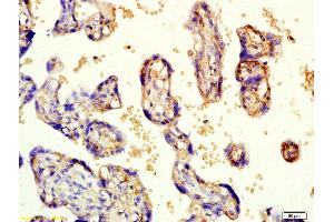 Formalin-fixed and paraffin embedded human placenta labeled with Rabbit Anti-KCNK3 Polyclonal Antibody, Unconjugated (ABIN682333) at 1:200 followed by conjugation to the secondary antibody and DAB staining