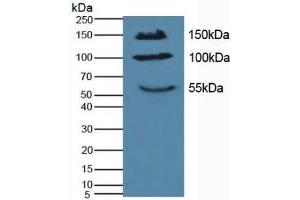 Detection of IL17RA in Mouse Pancreas Tissue using Polyclonal Antibody to Interleukin 17 Receptor A (IL17RA) (IL17RA Antikörper  (AA 590-848))