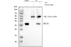 Immunoprecipitating (IP) Bcl-XL in A549 whole cell lysate.