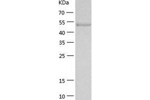 Western Blotting (WB) image for Muscle, Skeletal, Receptor Tyrosine Kinase (MUSK) (AA 22-468) protein (His tag) (ABIN7287552) (MUSK Protein (AA 22-468) (His tag))