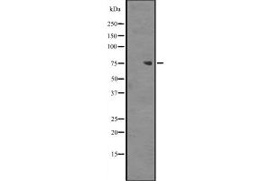 Western blot analysis of ZNF709 expression in Jurkat cell lysate,The lane on the left is treated with the antigen-specific peptide. (ZNF709 Antikörper  (N-Term))