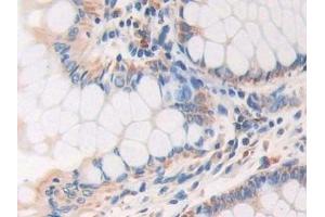 Immunohistochemistry (IHC) image for anti-A Kinase (PRKA) Anchor Protein 11 (AKAP11) (AA 1650-1901) antibody (ABIN7443557)