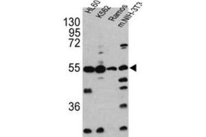 Western Blotting (WB) image for anti-Caspase 2, Apoptosis-Related Cysteine Peptidase (CASP2) antibody (ABIN2997249) (Caspase 2 Antikörper)