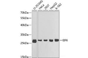 Western blot analysis of extracts of various cell lines using EIF6 Polyclonal Antibody at dilution of 1:1000. (EIF6 Antikörper)