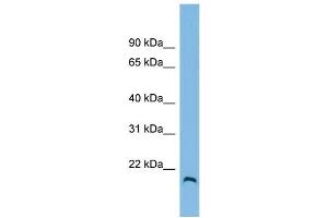 WB Suggested Anti-HFE2 Antibody Titration: 0. (HFE2 Antikörper  (N-Term))