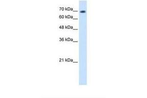 Image no. 1 for anti-Lethal(3) Malignant Brain Tumor-Like Protein 2 (L3MBTL2) (C-Term) antibody (ABIN324545) (L3MBTL2 Antikörper  (C-Term))