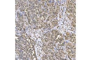 IHC analysis of SART1 using anti-SART1 antibody (ABIN7599884). (SART1 Antikörper  (AA 125-800))