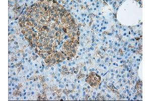 Immunohistochemical staining of paraffin-embedded liver tissue using anti-ALDH3A1 mouse monoclonal antibody. (ALDH3A1 Antikörper)