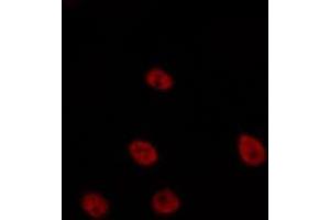 ABIN6275635 staining HepG2 by IF/ICC.