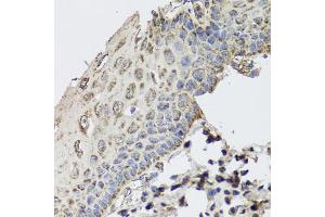Immunohistochemistry of paraffin-embedded human esophagus using GBF1 antibody. (GBF1 Antikörper)
