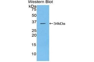 Western Blotting (WB) image for anti-Protein tyrosine Phosphatase, Receptor Type, J (PTPRJ) (AA 567-842) antibody (ABIN1860368) (PTPRJ Antikörper  (AA 567-842))