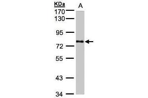 WB Image Sample(30 ug whole cell lysate) A:A431, 7. (GALNT6 Antikörper)
