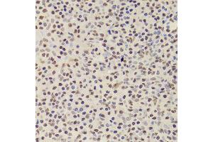 Immunohistochemistry of paraffin-embedded Human amygdalitis using ANP32A antibody at dilution of 1:100 (x400 lens). (PHAP1 Antikörper)