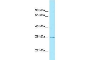 Western Blotting (WB) image for anti-Caudal Type Homeobox 2 (CDX2) (Middle Region) antibody (ABIN2777319)