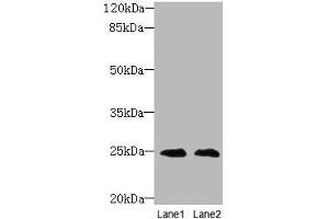 Western blot All lanes: TIMP3 antibody at 2 μg/mL Lane 1: EC109 whole cell lysate Lane 2: 293T whole cell lysate Secondary Goat polyclonal to rabbit IgG at 1/10000 dilution Predicted band size: 25 kDa Observed band size: 25 kDa (TIMP3 Antikörper  (AA 30-208))
