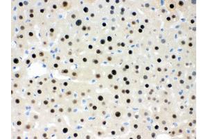 Immunohistochemistry (Paraffin-embedded Sections) (IHC (p)) image for anti-Retinoblastoma Binding Protein 4 (RBBP4) (AA 395-425), (C-Term) antibody (ABIN3043920) (Retinoblastoma Binding Protein 4 Antikörper  (C-Term))