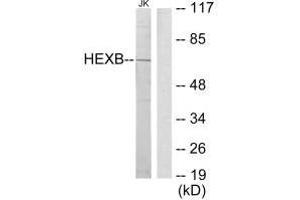 Western blot analysis of extracts from Jurkat cells, using HEXB antibody. (HEXB Antikörper  (C-Term))