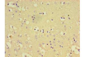 Immunohistochemistry (IHC) image for anti-Protein tyrosine Phosphatase, Non-Receptor Type 5 (Striatum-Enriched) (PTPN5) (AA 300-555) antibody (ABIN7174112)