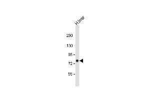 Anti-PCCA Antibody (Center) at 1:2000 dilution + human liver lysate Lysates/proteins at 20 μg per lane. (PCCA Antikörper  (AA 362-390))