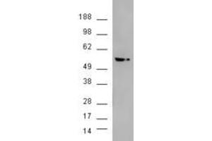 HEK293 overexpressing AKT3 (ABIN5421464) and probed with ABIN185314 (mock transfection in second lane). (AKT3 Antikörper  (AA 119-133))
