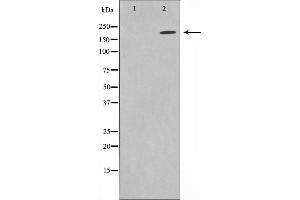 Western blot analysis on HuvEc cell lysate using Sodium Channel-pan Antibody,The lane on the left is treated with the antigen-specific peptide. (Sodium Channel-Pan Antikörper)
