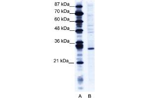 WB Suggested Anti-RNF141 Antibody   Titration: 1. (RNF141 Antikörper  (Middle Region))