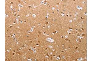 The image on the left is immunohistochemistry of paraffin-embedded Human brain tissue using ABIN7191852(PFN2 Antibody) at dilution 1/30, on the right is treated with synthetic peptide. (PFN2 Antikörper)