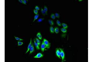 Immunofluorescence (IF) image for anti-Purinergic Receptor P2Y, G-Protein Coupled, 13 (P2RY13) (AA 162-190) antibody (ABIN7162457)