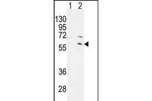 Western blot analysis of RPS6KL1 (arrow) using rabbit polyclonal RPS6KL1 Antibody (ABIN655281 and ABIN2844873). (RPS6KL1 Antikörper)