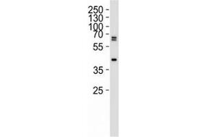 Western blot analysis of 293 lysate using SET07 antibody at 1:1000. (SETD8 Antikörper  (N-Term))