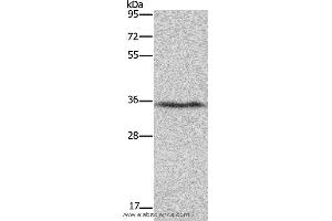 Western blot analysis of Human fetal liver tissue, using DDAH1 Polyclonal Antibody at dilution of 1:400