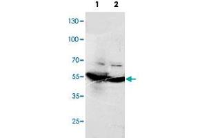 Western blot analysis of tissue lysates with DLD polyclonal antibody . (DLD Antikörper  (C-Term))