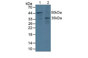 Western blot analysis of (1) Human Jurkat Cells and (2) Human A431 Cells. (DOK3 Antikörper  (AA 128-385))