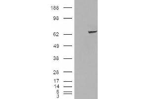 Western Blotting (WB) image for anti-Insulin-Like Growth Factor 2 mRNA Binding Protein 2 (IGF2BP2) antibody (ABIN5921444) (IGF2BP2 Antikörper)