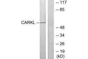 Western blot analysis of extracts from Jurkat cells, using CARKL antibody. (SHPK Antikörper  (N-Term))