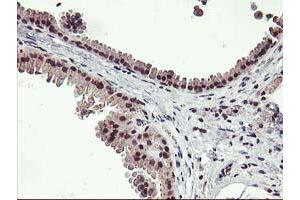 Immunohistochemical staining of paraffin-embedded Human breast tissue using anti-ZFP36 mouse monoclonal antibody. (ZFP36 Antikörper)